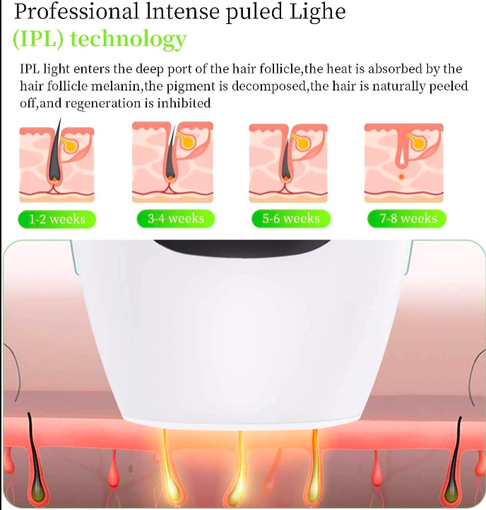 Illustration of IPL technology hair removal process with text and diagram.
