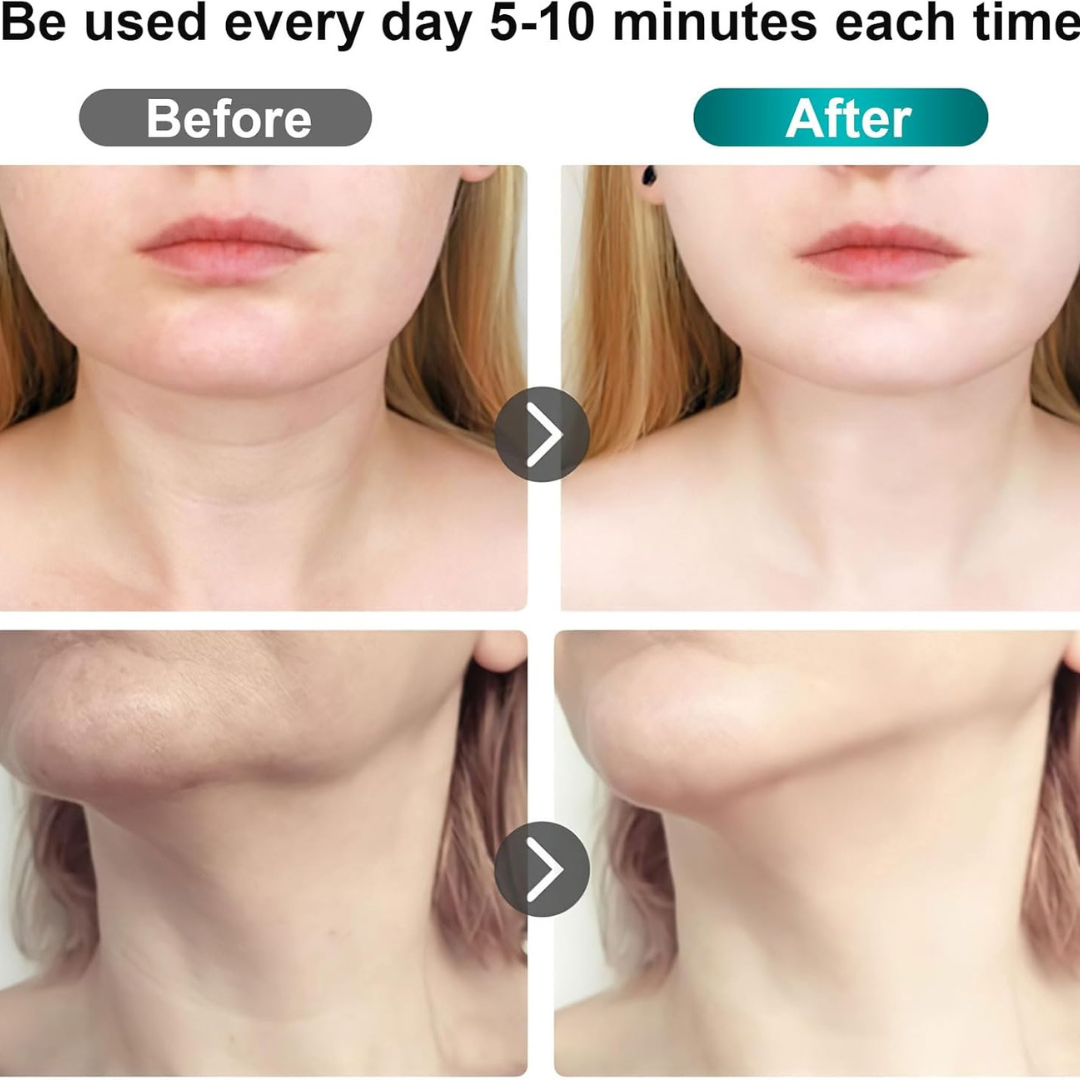 Advanced EMS Face Toning and Neck Lifting Device with Heat Therapy - Portable White